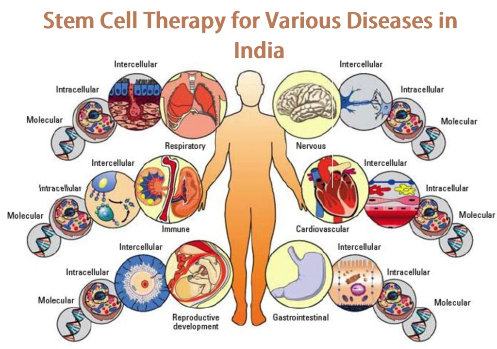 what-are-the-diseases-that-can-be-cured-using-stem-cell-therapy