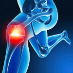 computer-navigated-knee-replacement-1