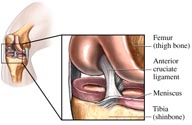 ligament injury symptoms, ligament surgery diagnosis, ligament injury surgery