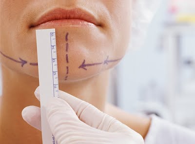 Chin Implant Surgery in India