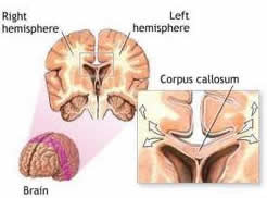 Low Cost Neurosurgery India