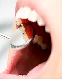 op Dentists and Best Dental Clinics in India