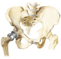 Hip Resurfacing Surgery in India