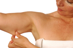 Lift Surgery India low cost advantages