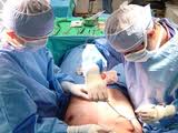 low cost male breast reduction surgery India