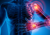 Stem Cell Therapy for Rheumatoid Arthritis in India
