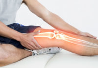arthroscopy knee surgery, arthroscopy knee surgery cost, arthroscopy knee surgery recovery time, arthroscopy knee surgery video, knee arthroscopy recovery exercises, arthroscopic knee surgery torn meniscus, arthroscopic knee surgery cost in india, arthroscopic knee surgery cost in bangalore, arthroscopic knee surgery cost in hyderabad, arthroscopic knee surgery cost in mumbai, meniscus tear surgery cost in india, arthroscopy knee surgery cost in chennai,