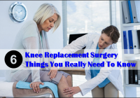 Knee Replacement Surgery 6 Things You Really Need to Know