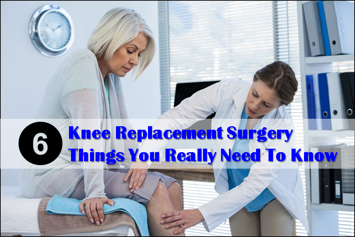 Knee Replacement Surgery 6 Things You Really Need to Know