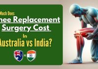 How-Much-Does-Knee-Replacement-Surgery-Cost-in-Australia-vs-India