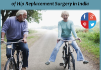 Hip replacement surgery India