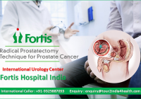 Radical Prostatectomy In India, cost of radical prostatectomy in india, radical prostatectomy in india cost, radical prostatectomy cost india, Radical Prostatectomy Success rates in India, successful Radical Prostatectomy in India, Success story of Radical Prostatectomy in India, cost of robotic radical prostatectomy in india, cost of radiation prostatectomy in india, average cost of radical prostatectomy in india, radical prostatectomy hospital in bangalore, radical prostatectomy surgeons in delhi,