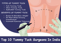 Tummy Tuck Surgery in India