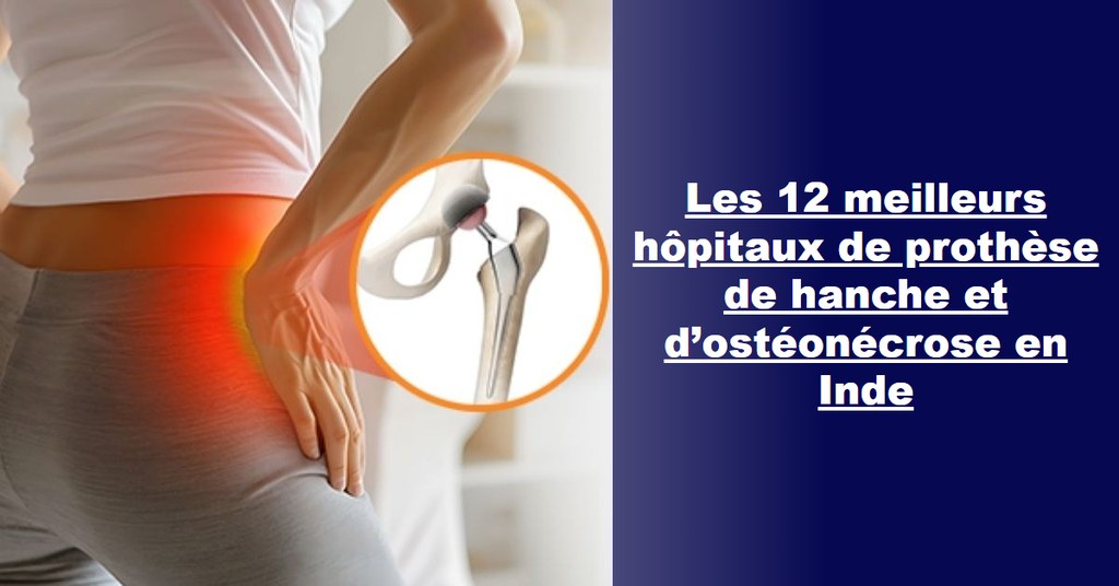 Les 12 meilleurs hôpitaux de prothèse de hanche et de traitement de l’ostéonécrose en Inde (guide 2026-2027)