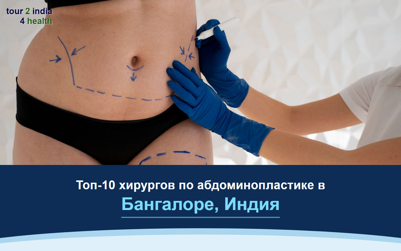 Топ-10 хирургов по абдоминопластике в Бангалоре, Индия – 2026-2027