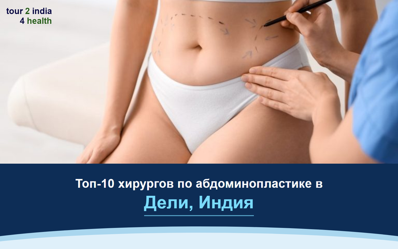 Топ-10 хирургов по абдоминопластике в Дели, Индия – 2026-2027