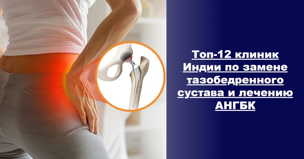 Топ-12 клиник Индии для эндопротезирования тазобедренного сустава и лечения АНГБК (гид 2026–2027)