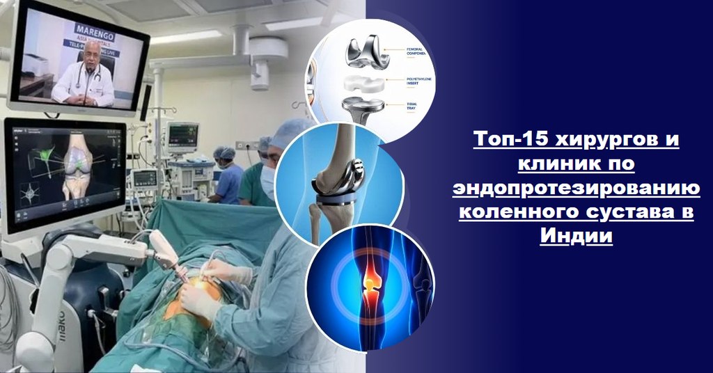 Топ-15 хирургов по эндопротезированию коленного сустава и клиник в Индии (гид 2026–2027)