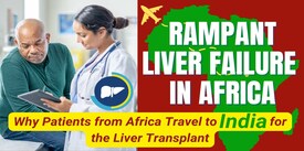 Rampant Liver Failure in Africa