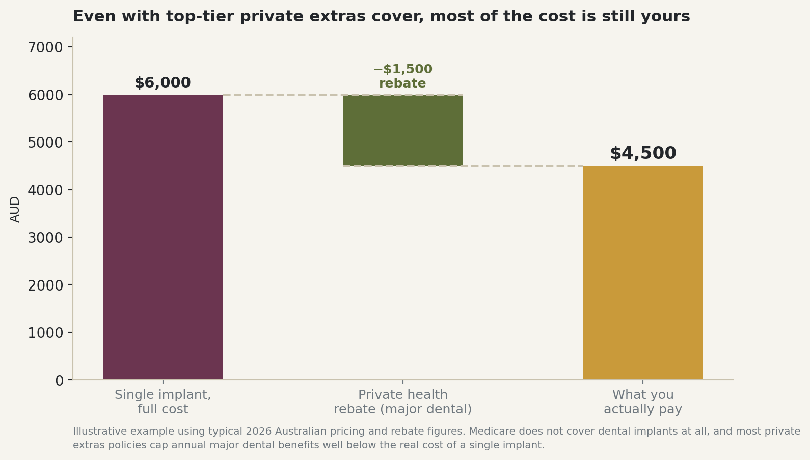 Chart: Even with top-tier private extras cover, most of the cost is still yours