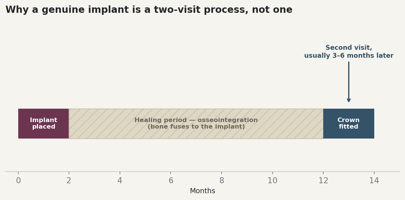 Chart: Why a genuine implant is a two-visit process, not one