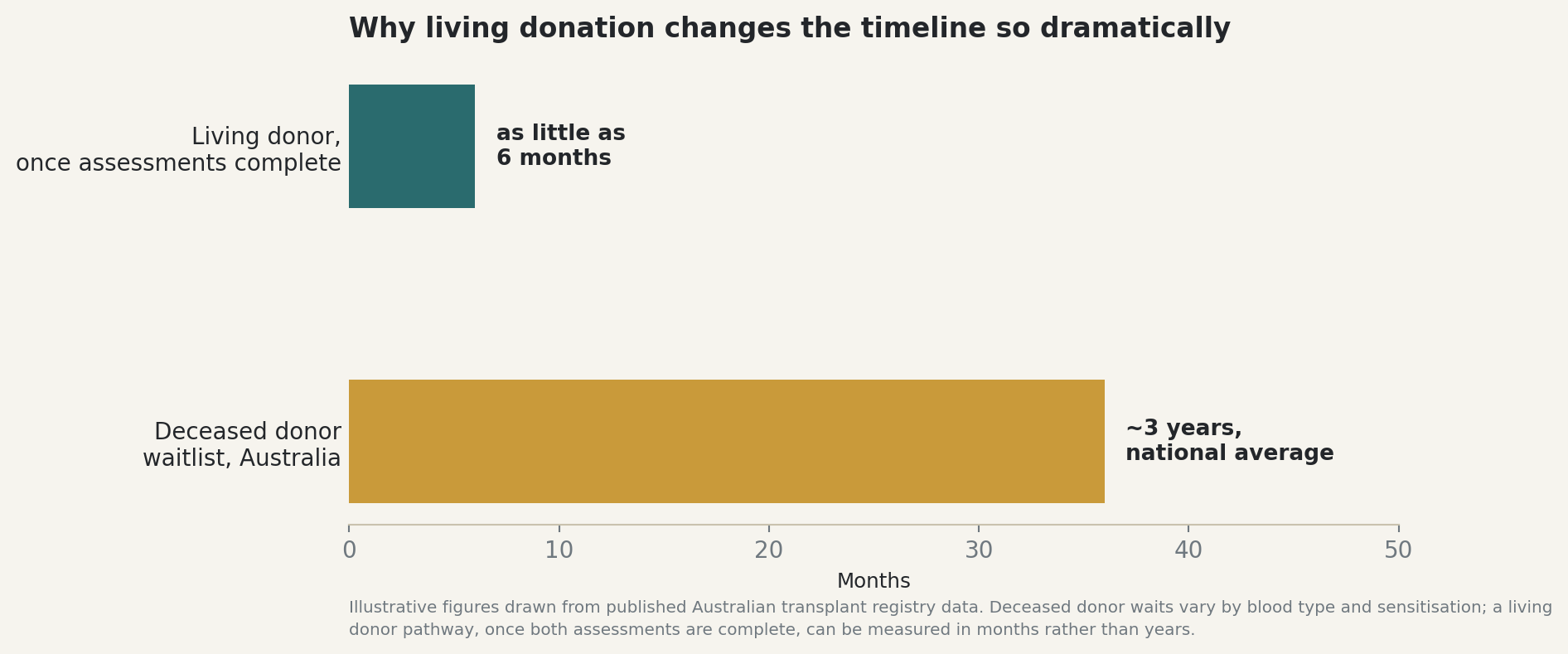 Chart: Why living donation changes the timeline so dramatically