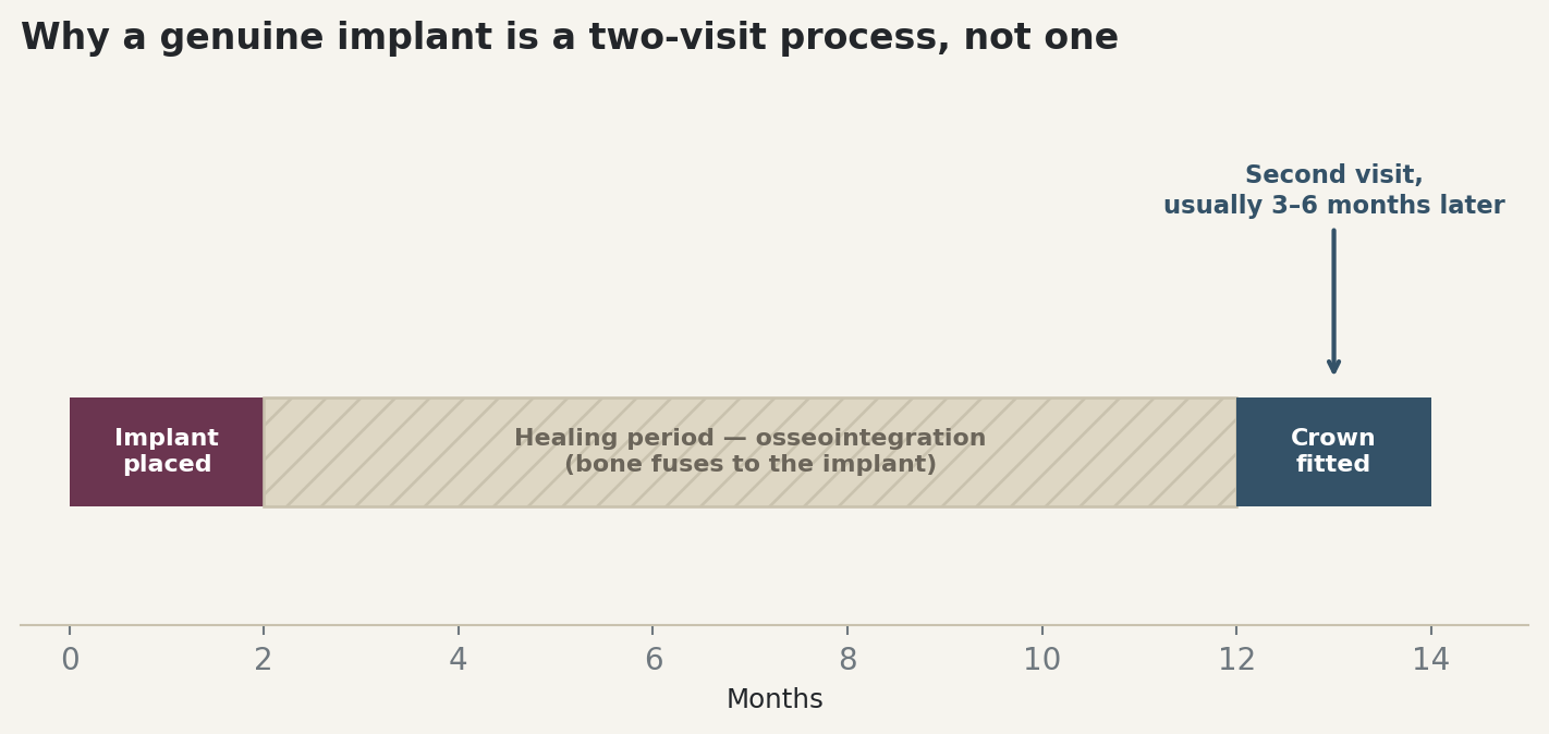 Chart: Why a genuine implant is a two-visit process, not one