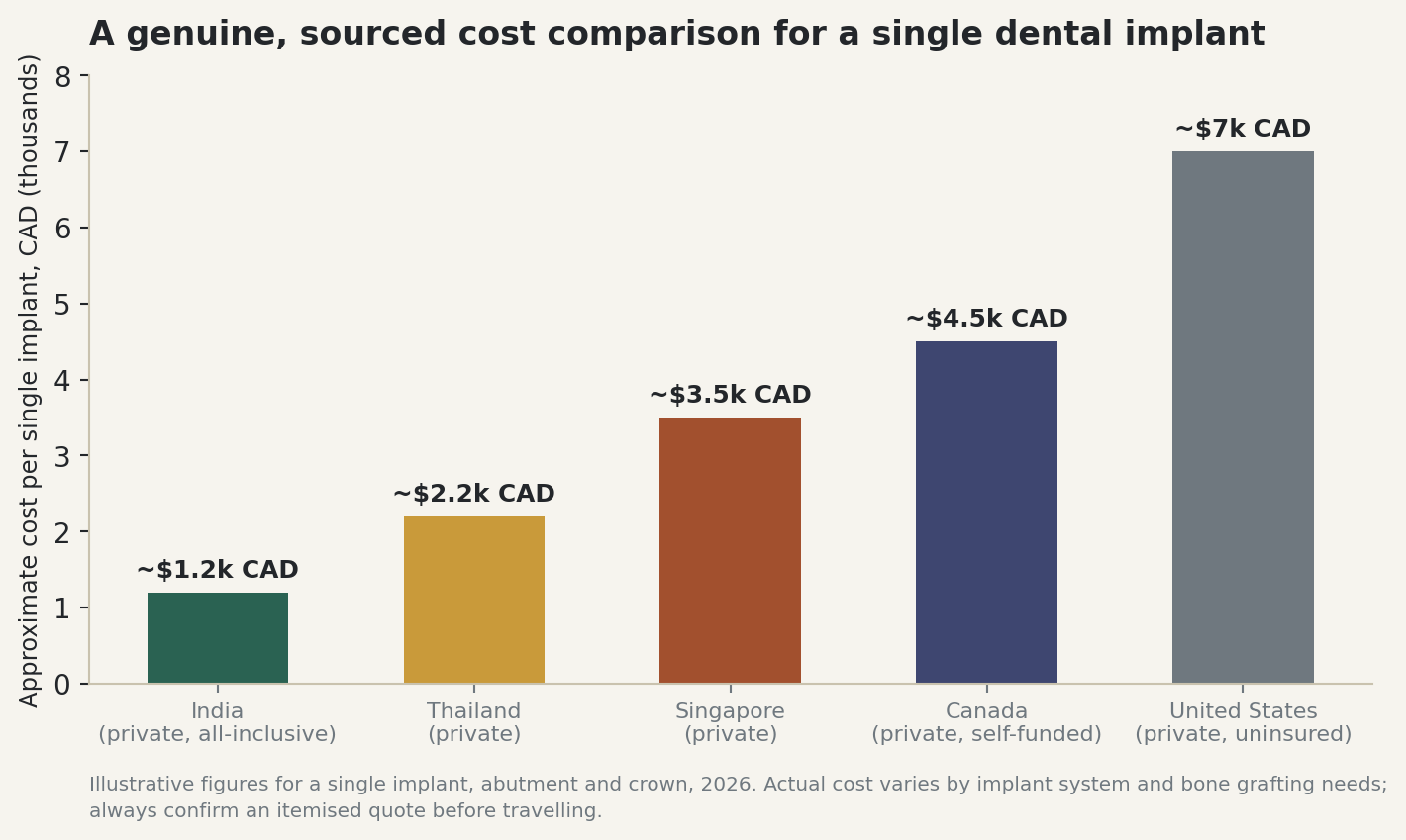 Chart: A genuine, sourced cost comparison for a single dental implant