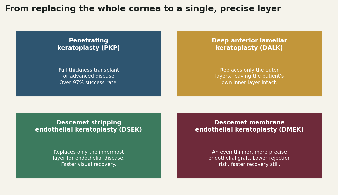Chart: From replacing the whole cornea to a single, precise layer