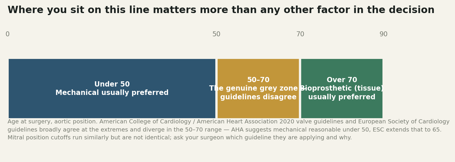 Chart: The decision that matters most is not made in the operating room