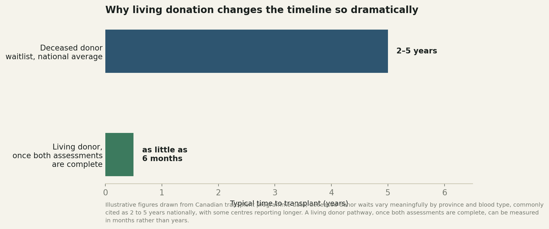 Chart: Why living donation changes the timeline so dramatically