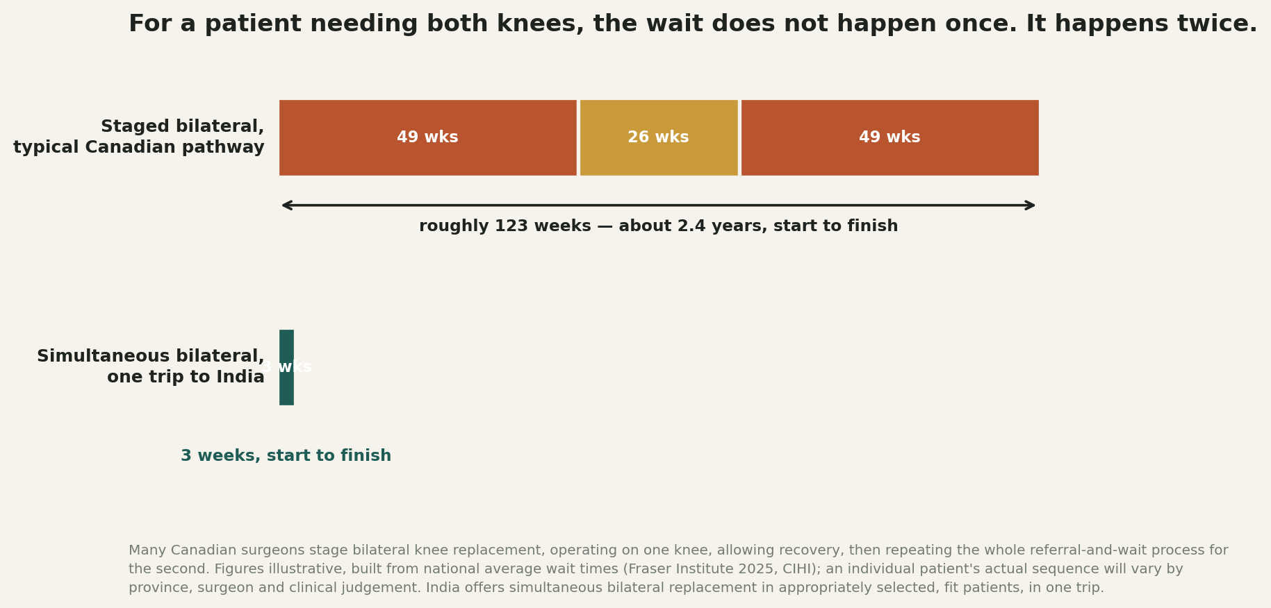 Chart: For a patient needing both knees, the wait does not happen once