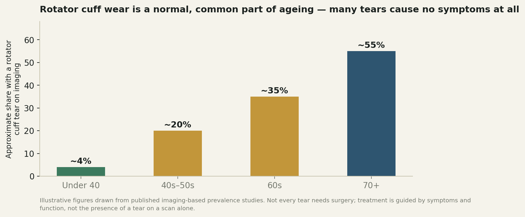 Chart: Shoulder wear is a normal part of getting older, and surgery for it is well established