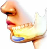 What-is Chin Augmentation india