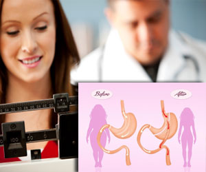 bariatric obesity surgery