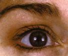 Dermatology