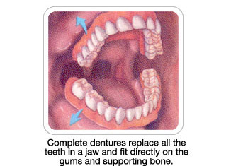 dentures1