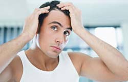 After Hair Replacement surgery in India