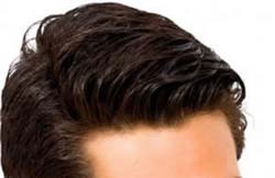 Benefits of Hair replacement surgery