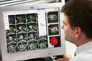 Gamma Knife Surgery Cost in India