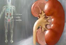 Kidney Treatment and Surgery in India