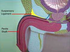 Penile Enhancement Surgery India