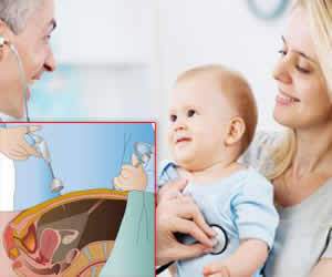 pediatric laparoscopy